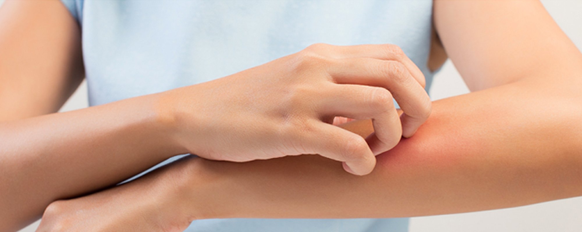 Are You Familiar with These Symptoms of Plaque Psoriasis?