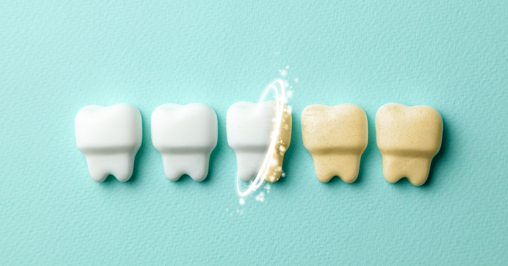Blanqueamiento De Dientes: La Clave Para Una Sonrisa Brillante