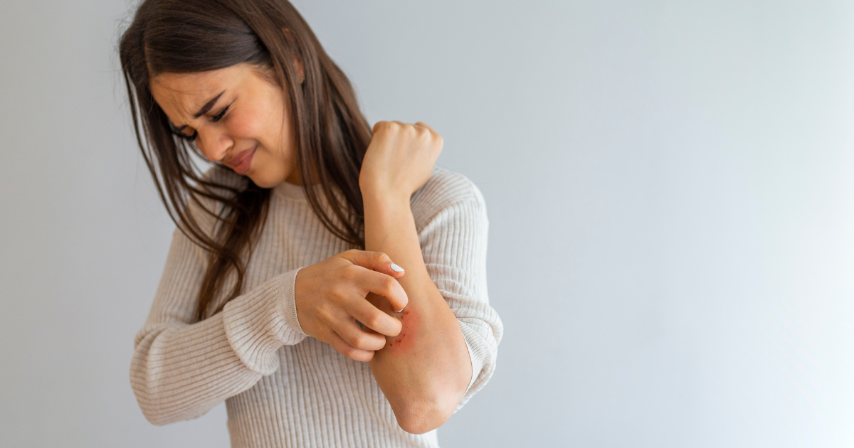 Uncovering the Typical Symptoms of Plaque Psoriasis