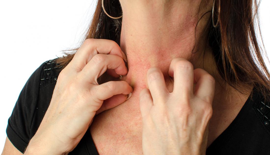Itchy Skin in Seniors: Causes, Remedies, and When to Seek Help!