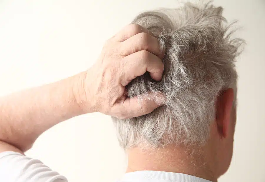 Understanding Dermatitis Rash in Seniors: Causes, Symptoms, and Relief Options